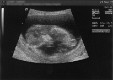  First scan